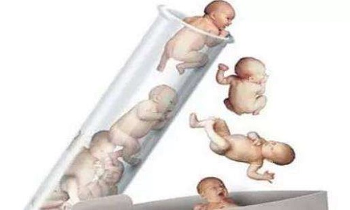 俄羅斯試管嬰兒哪個醫院好