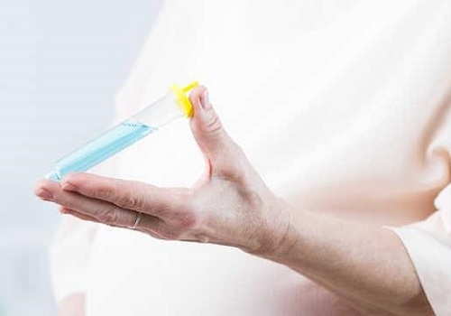 做俄羅斯試管嬰兒要什么手續嗎